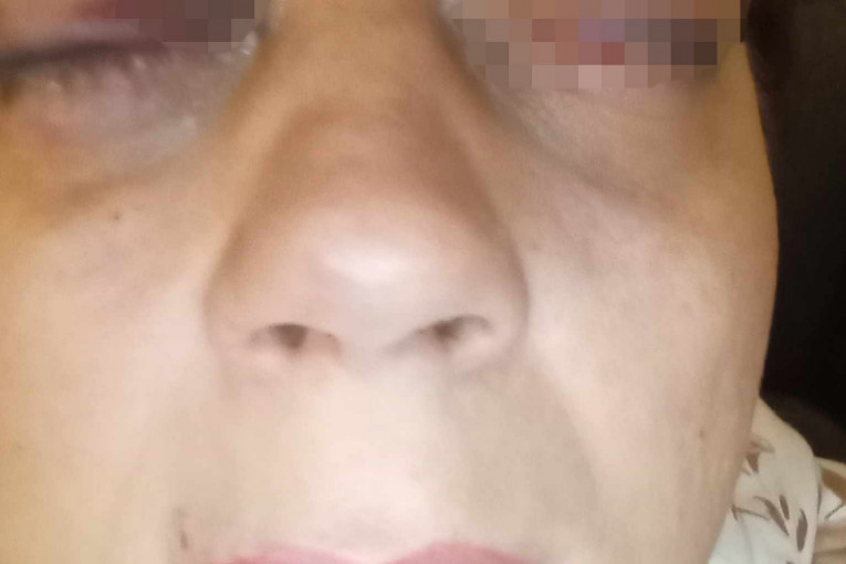 Beba Vasić pretučena