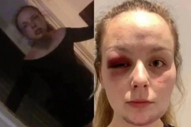 OTKRIVENA ŠOKANTNA PREVARA!  Britanka se udarala ČEKIĆEM i tvrdila da je bila žrtva trgovine ljudima i silovanja, a istina je užasna!