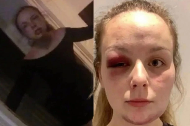 OTKRIVENA ŠOKANTNA PREVARA!  Britanka se udarala ČEKIĆEM i tvrdila da je bila žrtva trgovine ljudima i silovanja, a istina je užasna!