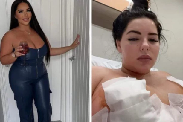 HTELA DA SE ULEPŠA, SADA JOJ BRADAVICE ODUMIRU: Tečnost curi na sve strane, njena sestra molila za pomoć - HIRURZI napravili "PAKAO" (FOTO)