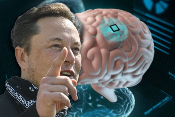 DA LI STE ZNALI? Jugoslavija je prva pokrenula ugradnju NANOTEHNOLOGIJA u organizam! Ilon Mask dosanjao NAŠ SAN!