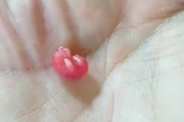 BRAČNI PAR JE PRONAŠAO NEOBIČNO STVORENJE U DVORIŠTU: Nisu ni sanjali da će iz njega izrasti ova životinja! (VIDEO)