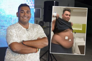 NECA LAZIĆ POKAZAO RANE NAKON OPERACIJE: Ceo u flasterima, podelio šokantan snimak! (VIDEO)