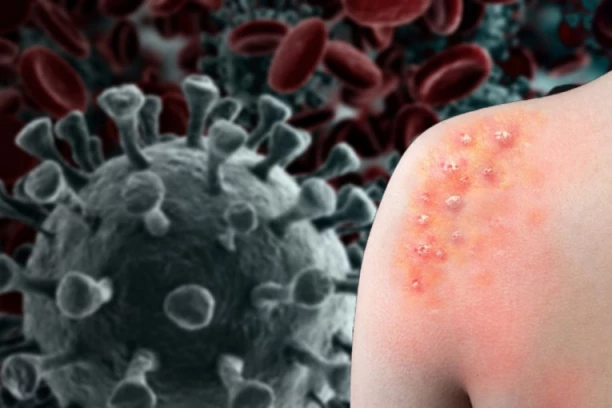 UMRLO I DRUGO DETE OD MALIH BOGINJA! Sve počne od upale pluća, a onda se ruši ceo imuni sistem