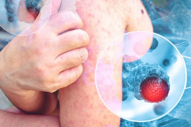 KOMBINACIJA STRAŠNIH ZARAZA HARA SRBIJOM! Deca prva na udaru, ČUVAJTE IH, može doći i do KOMPLIKACIJA, a ovo su PRVI SIMPTOMI