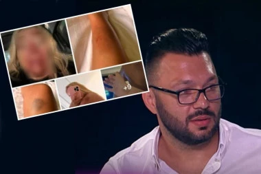 BIVŠI ZADRUGAR UNAKAZIO DEVOJKU OD BATINA: Uznemirujuće fotografije ugledale svetlost dana, javnost zanemela od šoka!