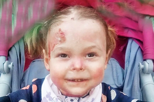 "DETE LEPTIR" DOBIJA LEK O TROŠKU DRŽAVE: Mala Nađa Marković počinje s terapijama