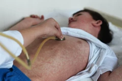 UMRLO NAJMANJE 86 DECE! Epidemija malih boginja, najmlađi ugroženi kao nikad pre