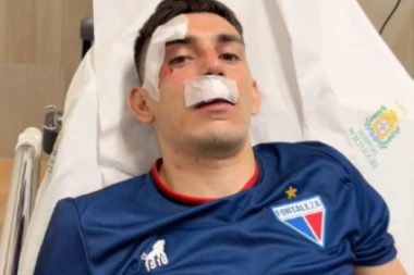 CIGLAMA RAZBIJENI PROZORI, KRVAVE GLAVE I PEŠKIRI! ŠOKANTNE scene u Brazilu! Navijači UNIŠTILI autobus i naneli žestoke povrede igračima! (VIDEO) (FOTO)