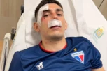 CIGLAMA RAZBIJENI PROZORI, KRVAVE GLAVE I PEŠKIRI! ŠOKANTNE scene u Brazilu! Navijači UNIŠTILI autobus i naneli žestoke povrede igračima! (VIDEO) (FOTO)