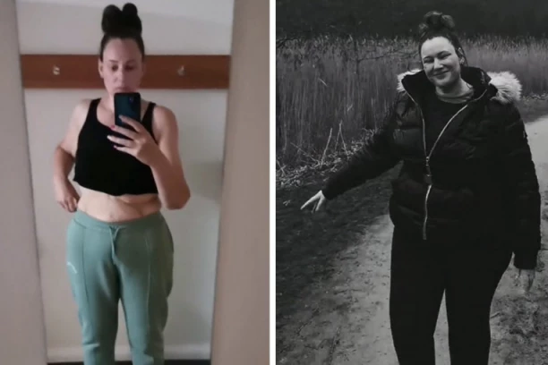 TOLIKO SAM BILA GOJAZNA DA SAM PILA LEKOVE ZA BOLOVE: Jedna stvar me totalno promenila, URADILA SAM OVO, i nikada se nisam vratila na staro (FOTO)