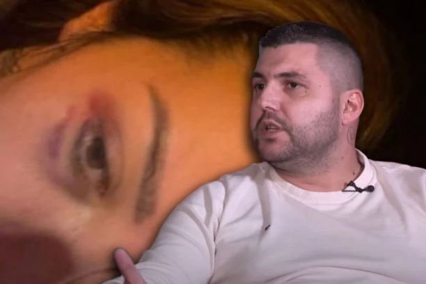 NAJBITNIJU STVAR IZ VEZE SA ASMINOM JOŠ NIJE IZNELA: Više puta je brutalno pretukao Aneli, a najgore ćete tek da čujete!