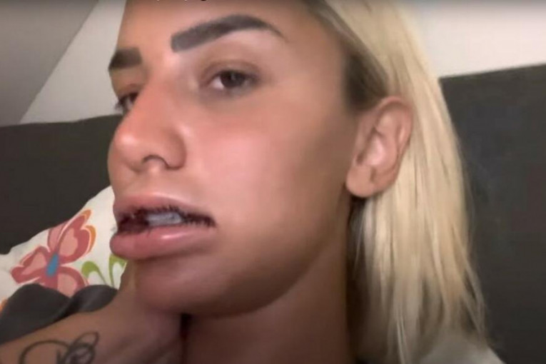 Aleksandra Nikolić operacija usana