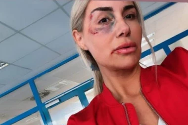 SELMA PLJUNULA NA ŽRTVE NASILJA: Otkrivamo SRAMNU pozadinu priče kako je Bajramijeva završila u MODRICAMA!