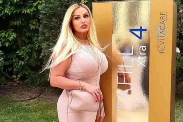 ČAK 40 ŽRTAVA LAŽNE ZUBARKE: Atraktivna plavuša po BAGATELA cenama radila OZBILJNE TRETMANE, a evo kako je "DOLIJALA"