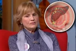 OVI VITAMINI POMAŽU MASNOJ JETRI DA SE OČISTI: Hepatolog otkriva da li je SURUTKA suvo zlato, evo koliko stvarno pomaže