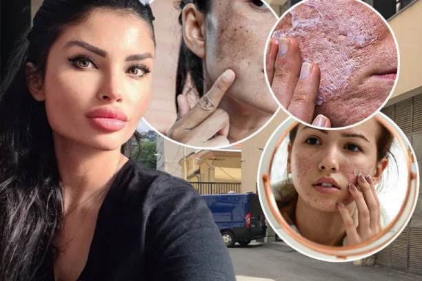 Barbi kvazi-doktorka "SPRŽILA" NOS DEVOJCI: Odbrana tvrdi da je lažirala fotografije - optužuju i veštaka