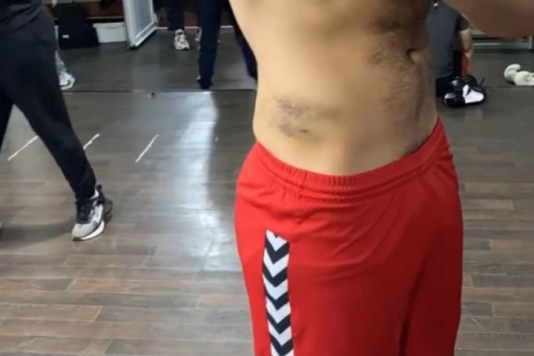 Marko Marković u modricama