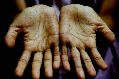 TAJNA SMRTONOSNOG OTROVA: Kako je arsen nevidljivi ubica postao globalni problem!