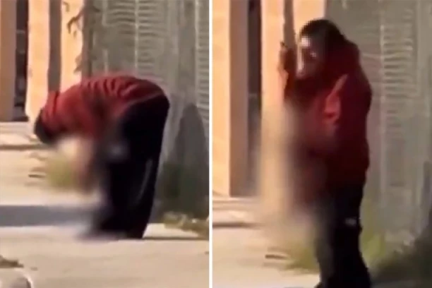 HOROR! Muškarac šetao ulicom sa otkinutom nogom u rukama!