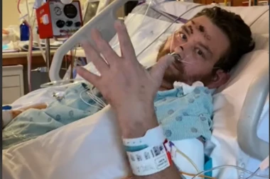 NAKON ŠTO MU JE URASLA DLAKA NA PREPONIMA - PAO JE U KOMU: Sve se OVAKO zakomplikovalo, lekari sada UPOZORAVAJU!