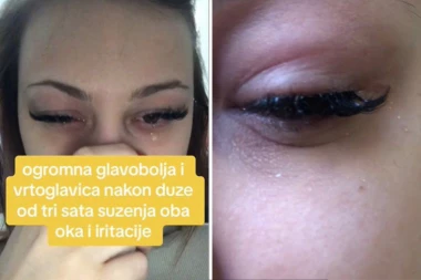 OTIŠLA KOD KOZMETIČARKE, A VRATILA SE SA GLAVOBOLJOM I VRTOGLAVICOM: Bolovi je UNIŠTAVALI nedeljama i to zbog tretmana koji rade sve žene! (FOTO/VIDEO)