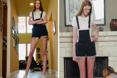 "MOMCI SE STIDE DA IZLAZE SA MNOM ZBOG MOJE VISINE": Devojka sa najdužim nogama na svetu na meti uvreda (VIDEO)