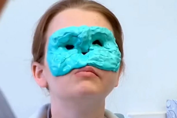 NEMA POLA LICA JER JE UPUCANA PUŠKOM: Hirurzi odlučili da je obraduju OVAKO, kada je stavila suze niko nije mogao da zadrži (FOTO/VIDEO)