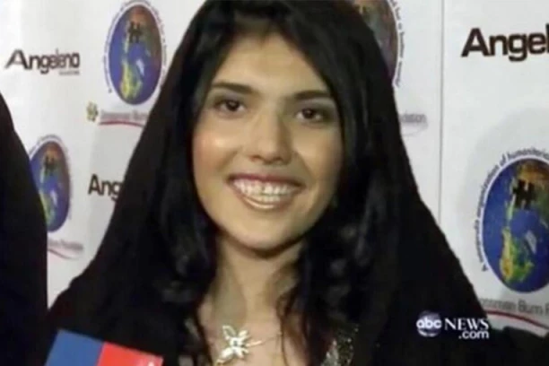 OVOJ ŽENI MUŽ JE ODSEKAO NOS I UŠI: Slike unakaženog lica objavljene su JAVNO, a fotka nakon OPERACIJE sve je rasula na komade!