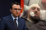 PETAR PETKOVIĆ OŠTRO OSUDIO PREBIJANJE I HAPŠENJE SRBINA:  "To su očigledno vrednosti koje tzv. Kosovo preporučuju za Savet Evrope" (FOTO)