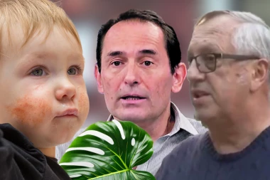 FILADENDRON MOŽE DA BUDE I OPASAN ZA DECU! Lekari šokirani slučajem lečenja ekcema od strane uglednog pedijatra: Smatram ih prevarantima!