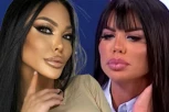 DRAGANA MITAR RASKRINKALA MAJU MARINKOVIĆ: Iznela istinu o PLASTIČNIM OPERACIJAMA bivše drugarice! (FOTO)