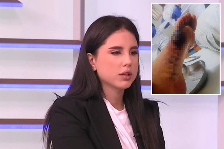 "VIDELA SAM KOST U STOPALU, A ON JE TVRDIO DA JE TO MLADA KOŽA" Žrtva lažnog lekara progovorila o HORORU koji je preživela nakon intervencije (UZNEMIRUJUĆE SLIKE)