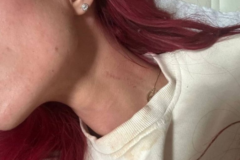 Tara Simov pretučena slike