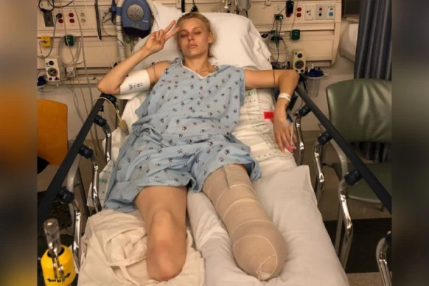 ZBOG TAMPONA JOJ ISTRULILO TKIVO, PA IZGUBILA OBE NOGE: Manekenka imala i DVA SRČANA UDARA, sada izgleda ovako (FOTO)