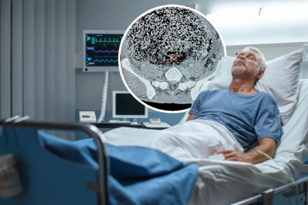 OVO NIKAKO NE JEDITE, MOŽE BITI S FATALNIM ISHODOM! Muškarac primljen u bolnicu sa plikovima, otečenošću i truljenjem kože na desnoj ruci!