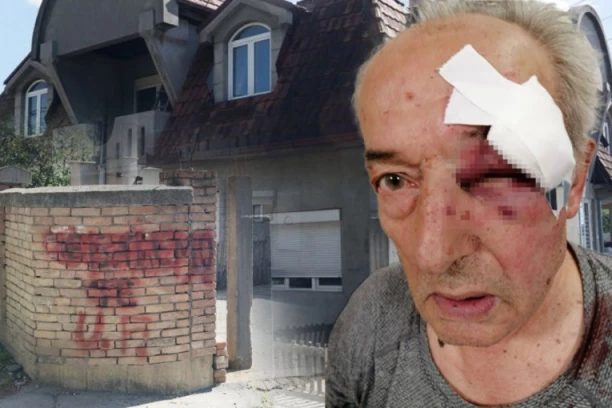 EKSKLUZIVNO! Pretučeni general progovorio za Republiku, otkrio sve detalje brutalnog napada: Jedan od njih se odao...