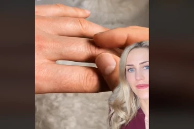 OVAKO PROVERITE DA LI UNOSITE DOVOLJNO VODE: Znaci dehidracije vide se na ovom delu TELA i nepogrešivi su (VIDEO)