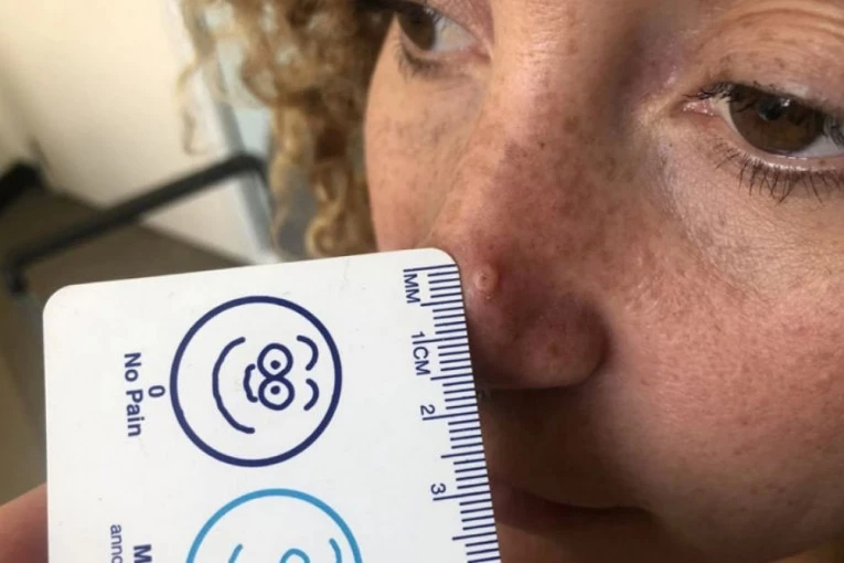 U 8. MESECU TRUDNOĆE MI JE IZAŠLA BUBULJICA NA NOSU: Prvi rezultati su bili dobri, ali onda je usledio pakao