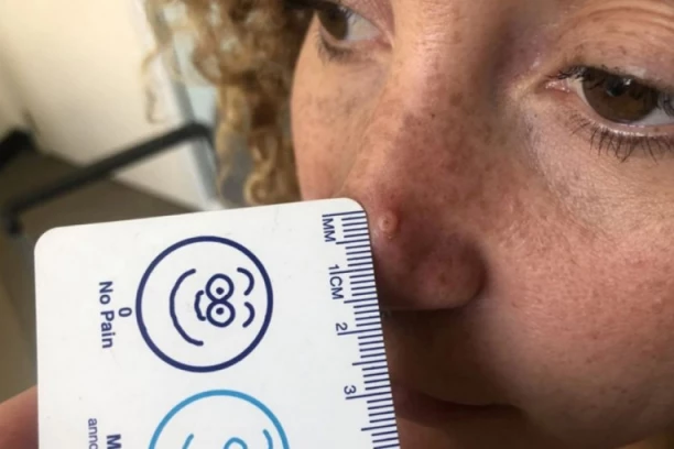 U 8. MESECU TRUDNOĆE MI JE IZAŠLA BUBULJICA NA NOSU: Prvi rezultati su bili dobri, ali onda je usledio pakao