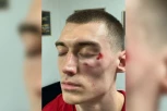 OVAKO JE NANELI UDARIO LAZAREVIĆA I ISEKAO MU LICE: Procureo snimak incidenta u Areni (VIDEO)