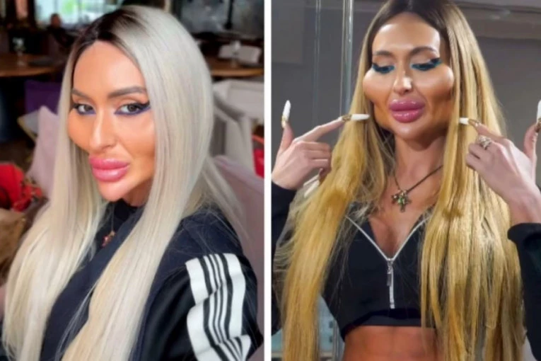 ANASTASIJA JE "HODAJUĆA PLASTIKA": "Ovo je čist dokaz da treba da odete kod dobrog psihijatra"