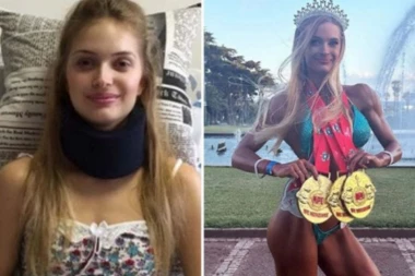 POLOMILA JE KIČMU, LEKARI SU REKLI DA ĆE OSTATI NEPOKRETNA: Danas grmi kako izgleda, svaki deo tela joj je zategnut