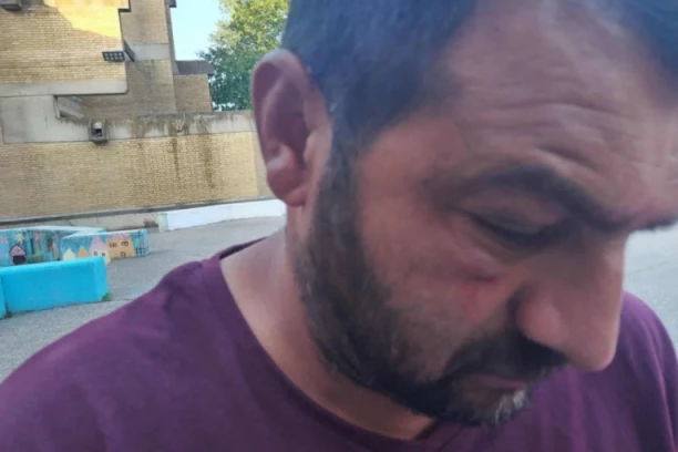 NE PRESTAJE NASILJE OPOZICIJE ! HAOS koji prave u gradovima se preliva u manje sredine – Fizički napad na člana SNS u Vajskoj!