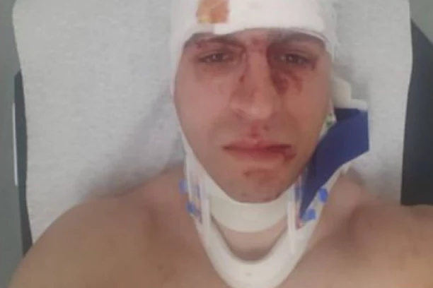 TEŠKA SAOBRAĆAJKA NEPOSREDNO PRE ULASKA NA IMANJE: Muzičar bio totalno unakažen, sav krvav i u zavojima!