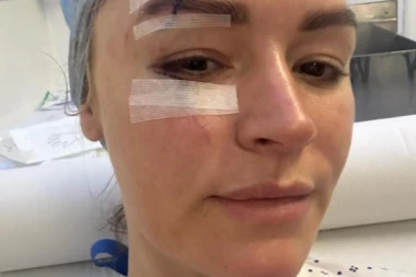 ISKASAPLJENA POZNATA VODITELJKA: Hitno hospitalizovana, pojavile se PRVE FOTKE, LICE joj UNAKAŽENO!