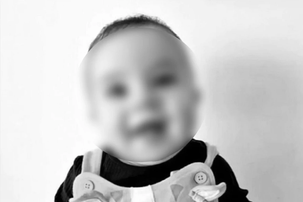 HOROR! LEKARI SU POKUŠALI DA JE SPASU! Ovo je beba koju je NASMRT izujedao porodični pas! Grizao je po glavi! (FOTO)