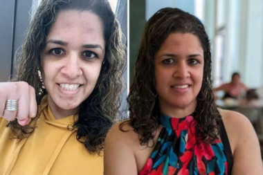 SA 33 SAM RODILA DETE I VIŠE NISAM MOGLA DA POMERIM RUKU: Nakon 3 godine sam dobila dijagnozu koja je promenila sve