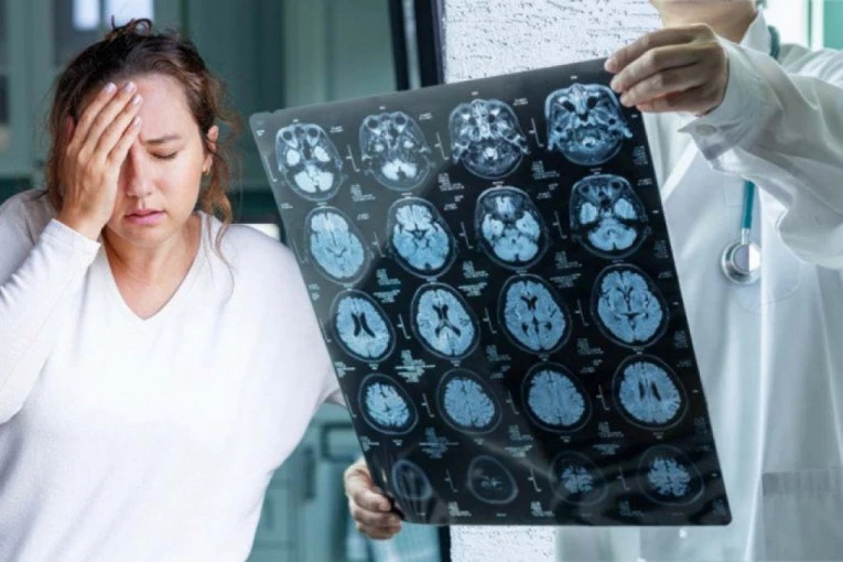 DA NISAM OTIŠLA KOD OČNOG LEKARA, SAD BIH BILA MRTVA! Kada je primetila da zaboravlja stvari i da su iznenadne dremke sve češće, Alison je to pripisala godinama