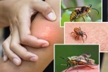 ŠTA DA RADITE KAD VAS UJEDU OSA, KRPELJ ILI OBAD? Kako da znate koja vas je buba ujela i kada da tražite pomoć lekara